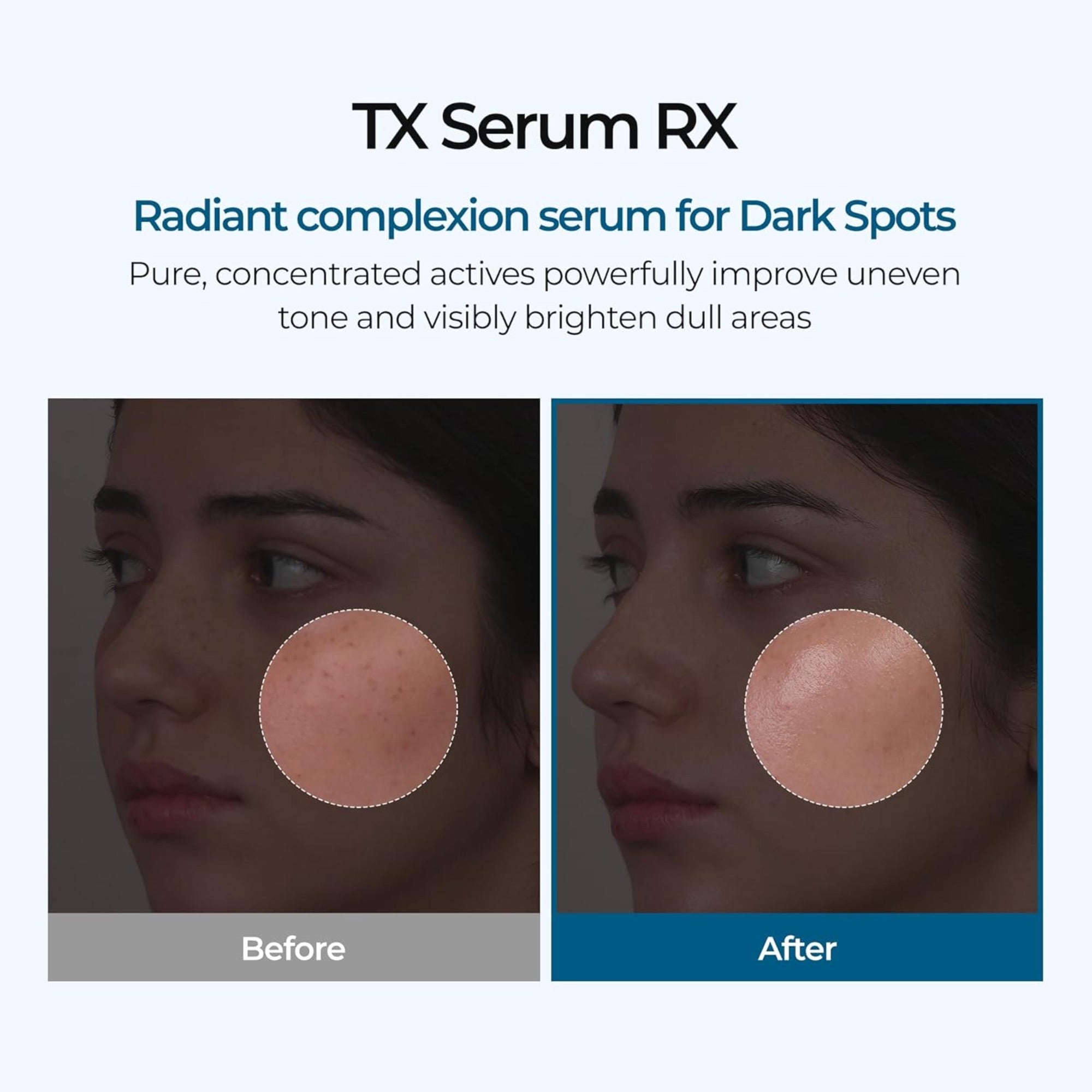 Dr. Melaxin TX Brightening Pigmentation Ampoule (30ml)