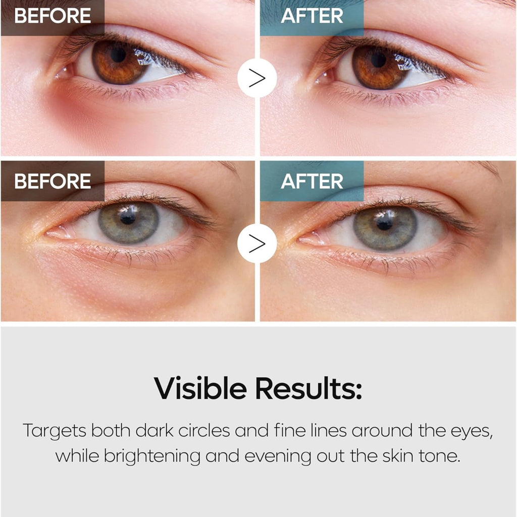 Dr. Melaxin TX Retinalsome Double Effect Eye Cream (40g)
