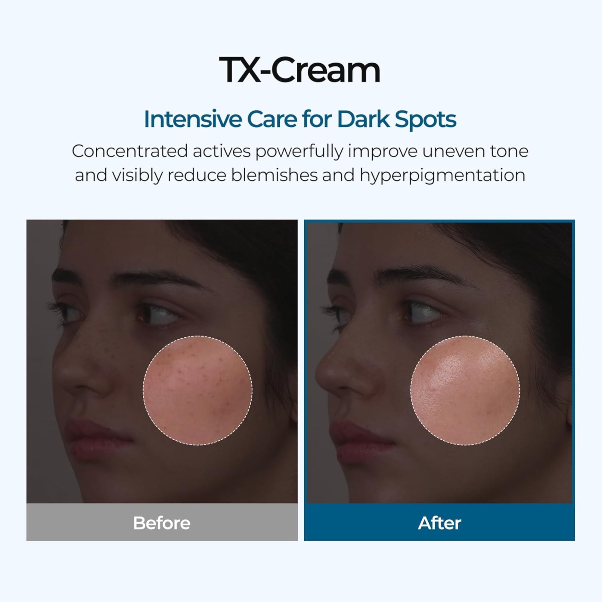 Dr. Melaxin TX Brightening Pigmentation Cream (50ml)