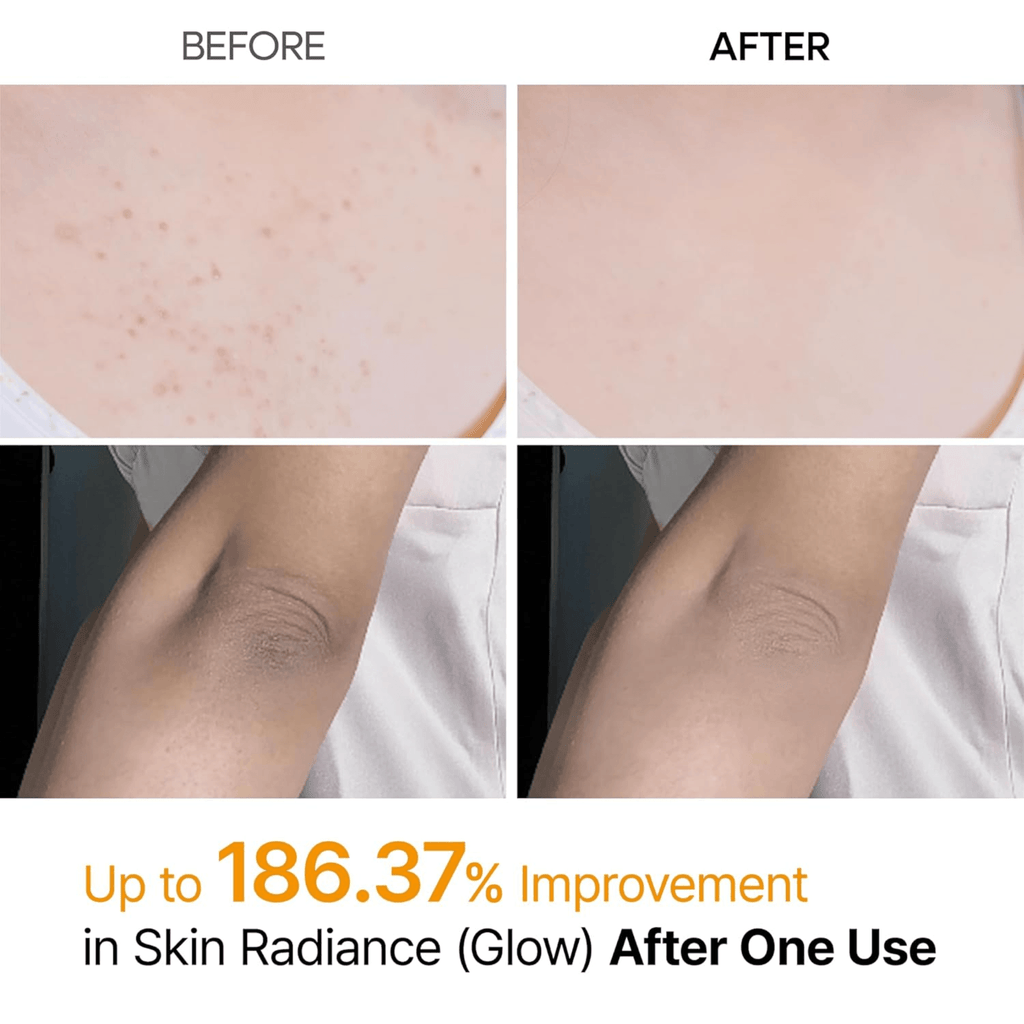 Dr. Melaxin Peel Shot Kojic Acid Turmeric Body & Foot Spray (200ml)