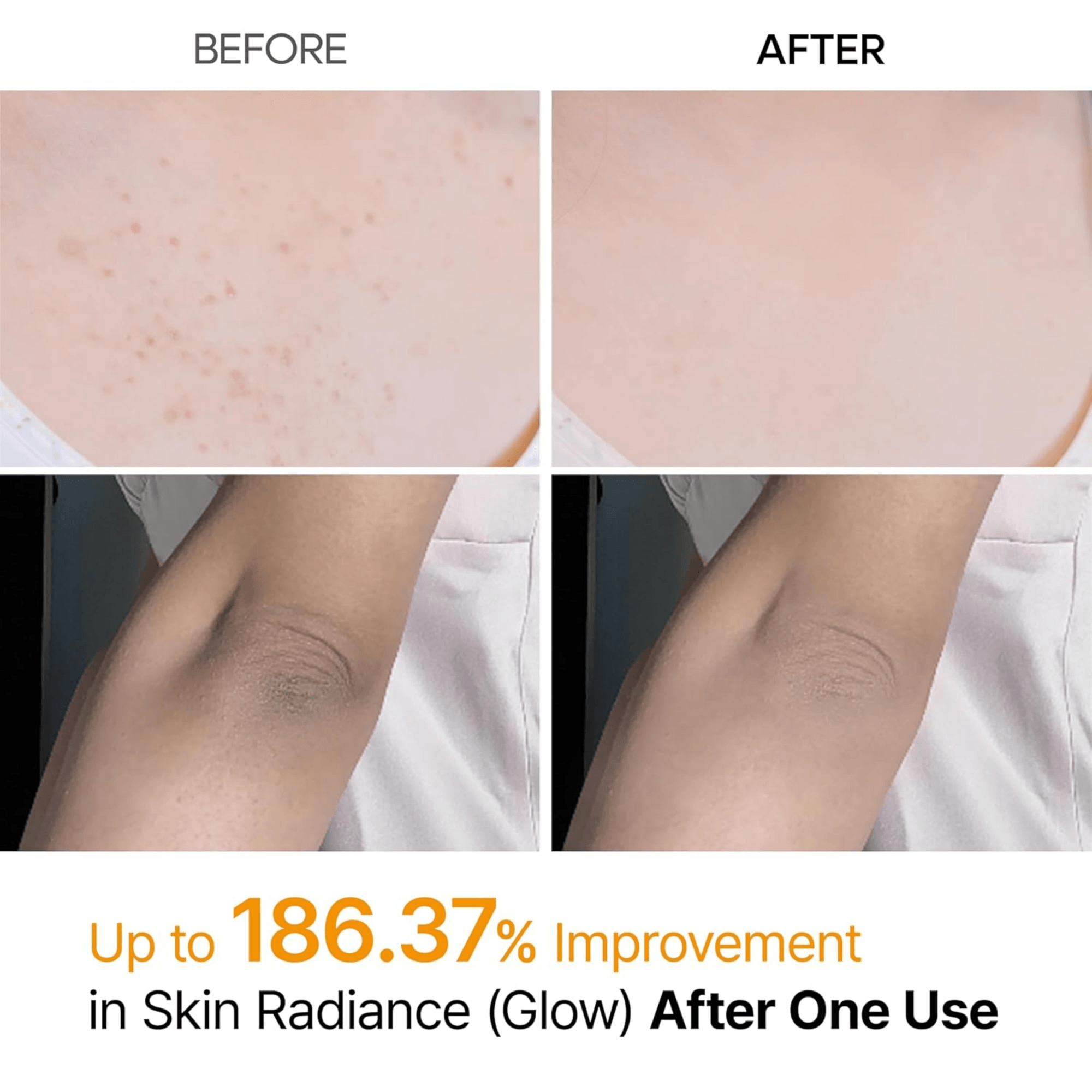 Dr. Melaxin Peel Shot Kojic Acid Turmeric Body & Foot Spray (200ml)