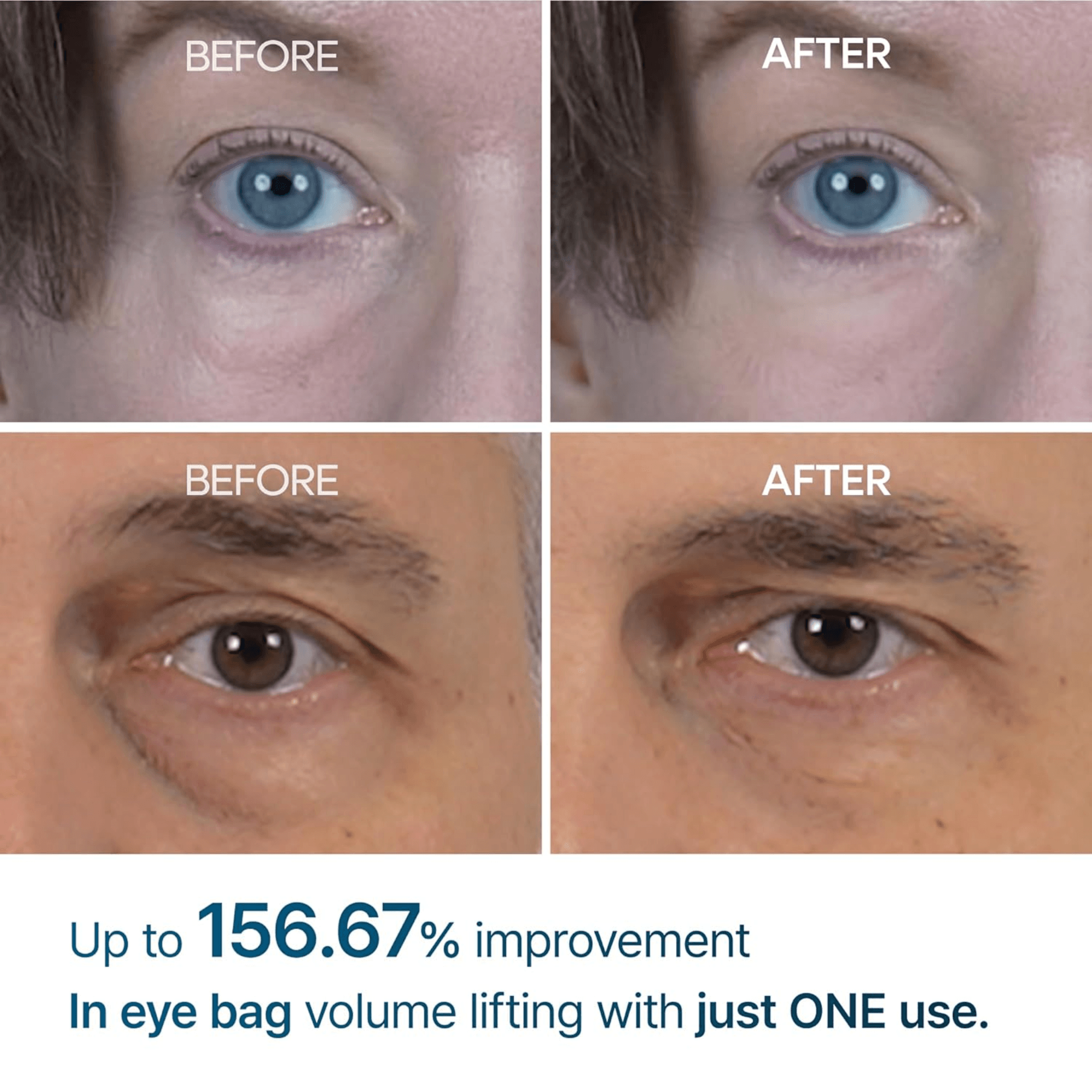 Dr. Melaxin Eyephalt Eyebag Tightening Cream (10ml)