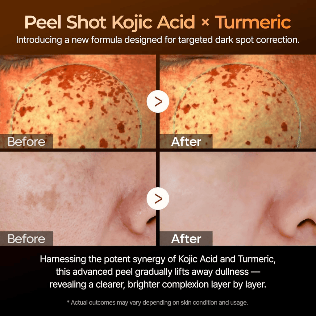 Dr. Melaxin Kojic Acid Turmeric Exfoliating Serum (80ml)
