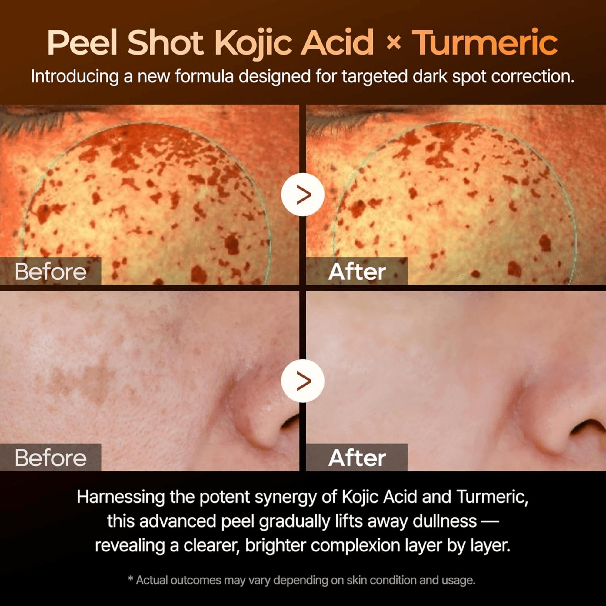 Dr. Melaxin Kojic Acid Turmeric Exfoliating Serum (80ml)