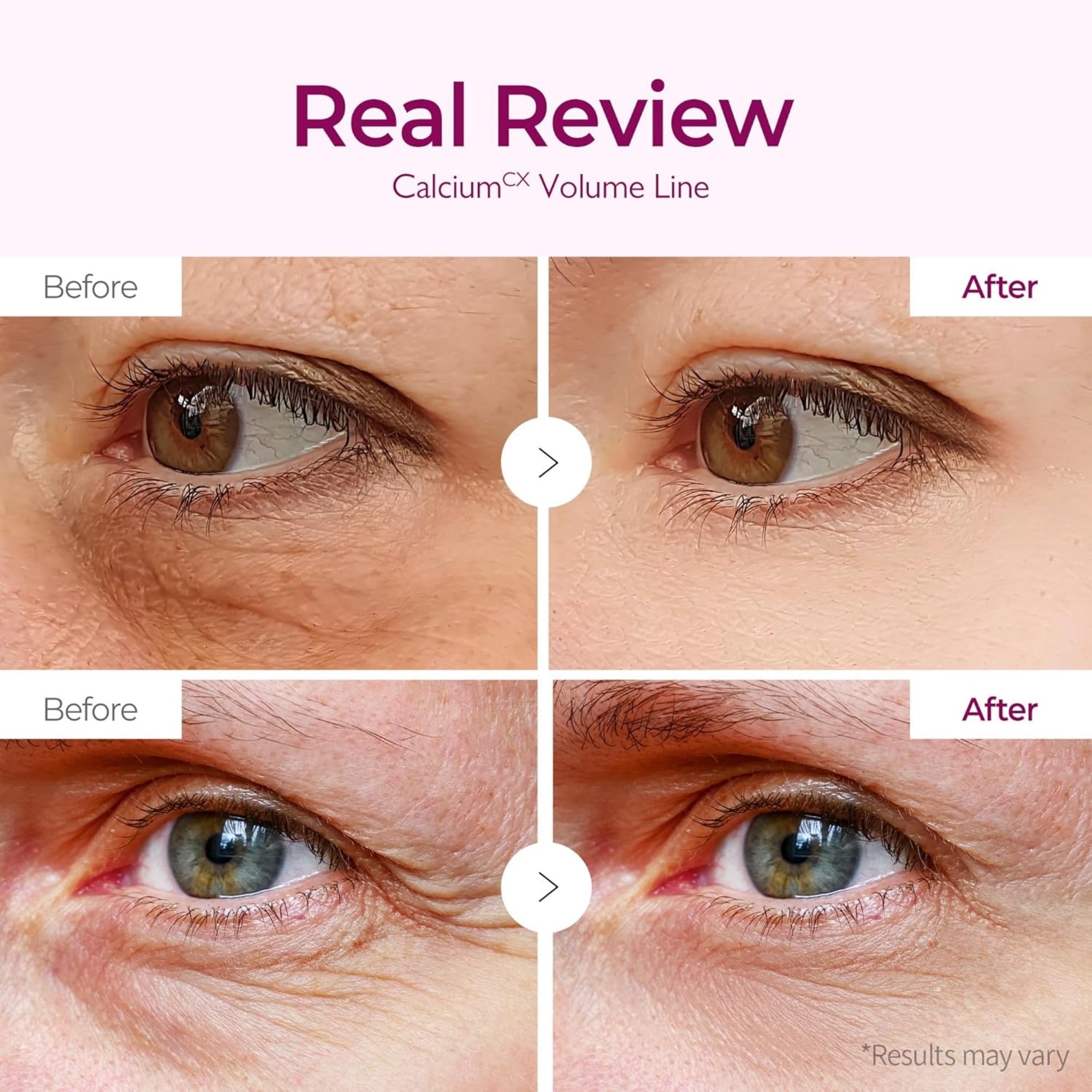 Dr. Melaxin Cemenrete Calcium Volume Eye Patch (60ea)