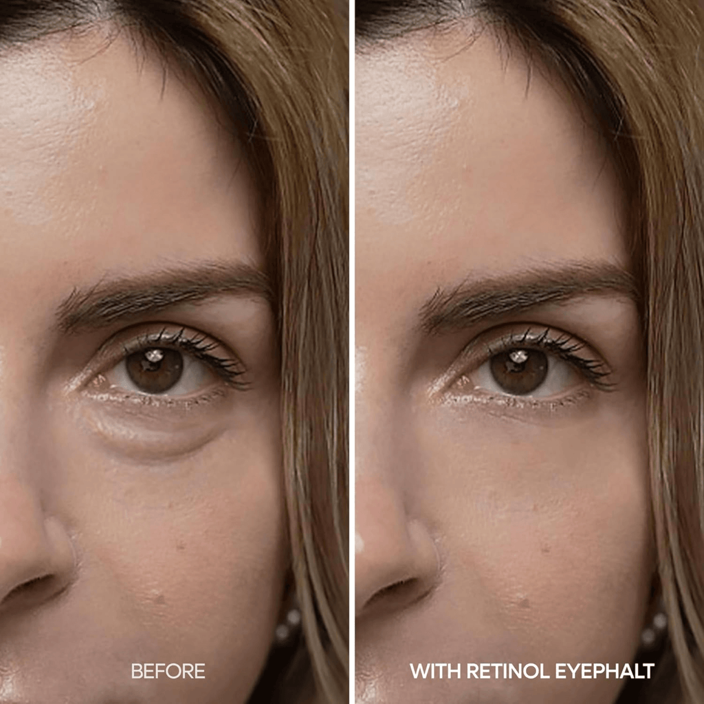 Dr. Melaxin Retinol Eyephalt Eyebag Cream (10ml)