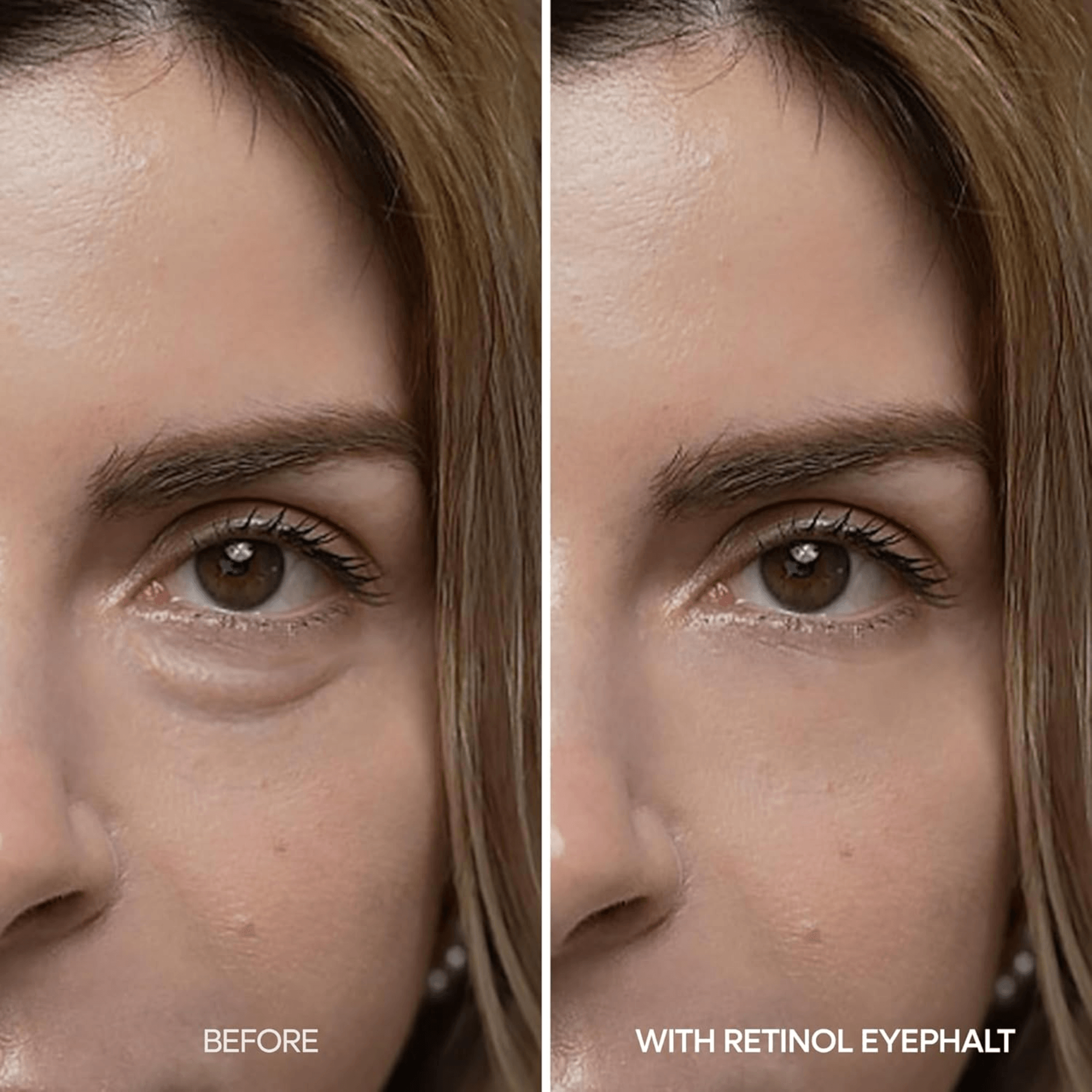Dr. Melaxin Retinol Eyephalt Eyebag Cream (10ml)