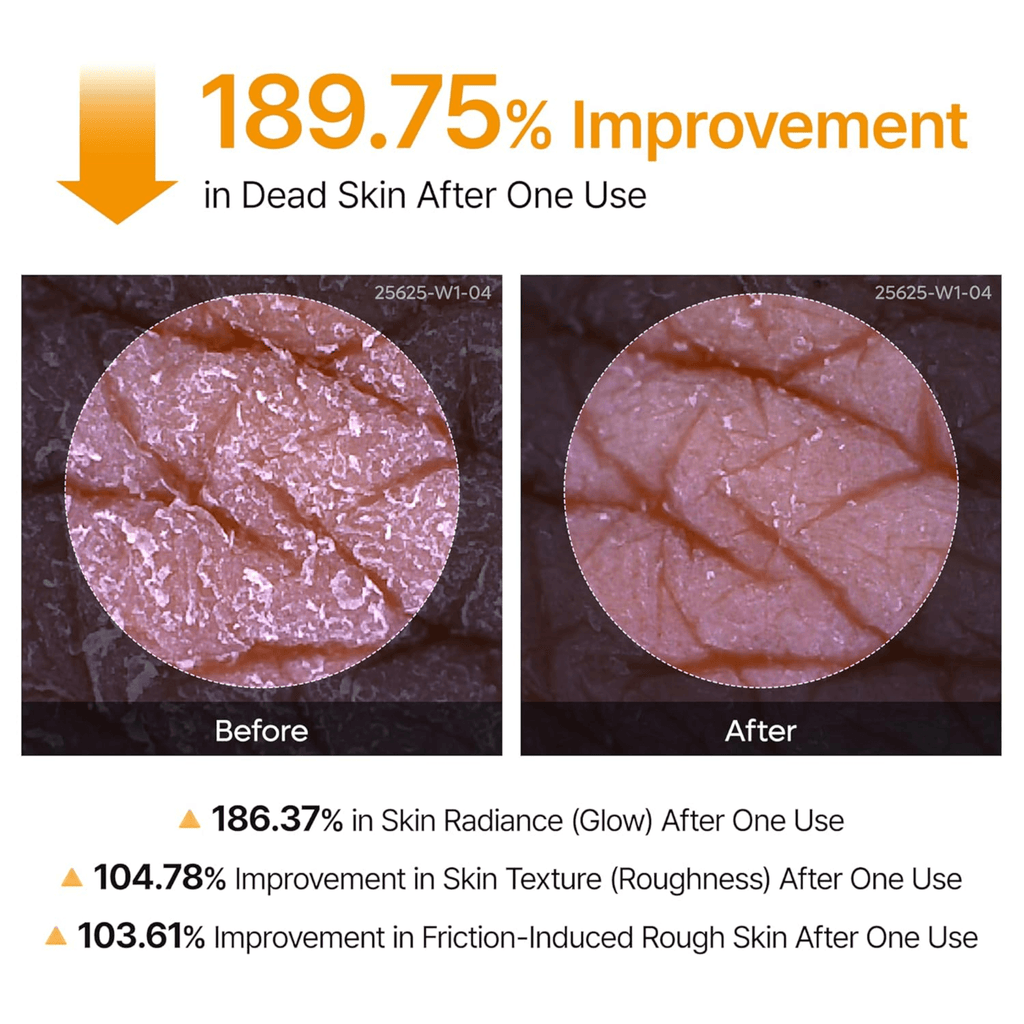 Dr. Melaxin Peel Shot Kojic Acid Turmeric Body & Foot Spray (200ml)