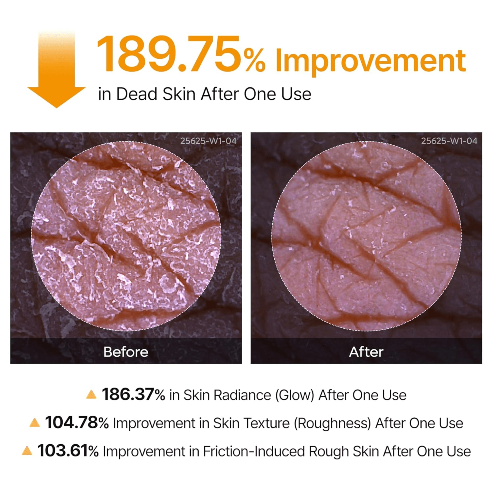 Dr. Melaxin Peel Shot Kojic Acid Turmeric Body & Foot Spray (200ml)