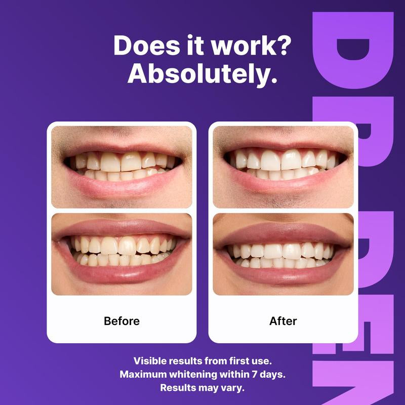 Radiant Smile Whitening Strips